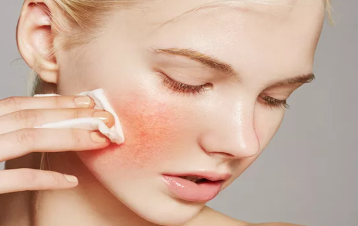 海口做完彩光嫩肤后皮肤会肿吗