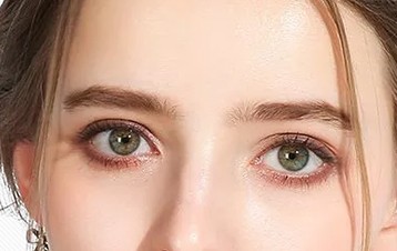 海口双眼皮做完两边大小不一样怎么办？