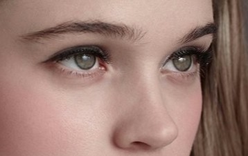 三亚鼻头鼻尖整形要多少钱?