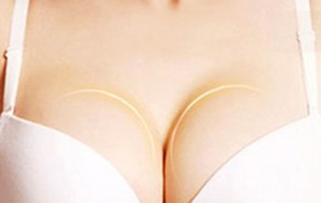 海南假体隆胸后可以按摩吗？